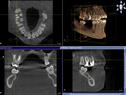 2-dvt-ebenen.jpg